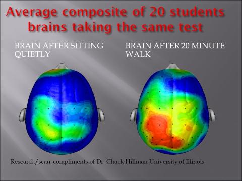 brain scan